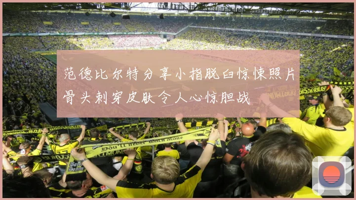 范德比尔特分享小指脱臼惊悚照片骨头刺穿皮肤令人心惊胆战